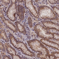 CCDC9B Antibody, Novus Biologicals 0.1mL; Unlabeled:Antibodies, Polyclonal
